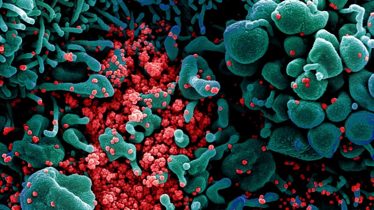 Video zachytilo smrtící nálož koronaviru postupující tělem