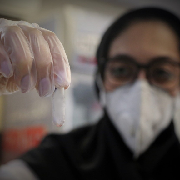 Příští pandemii mohou rozpoutat bioteroristé z garáže
