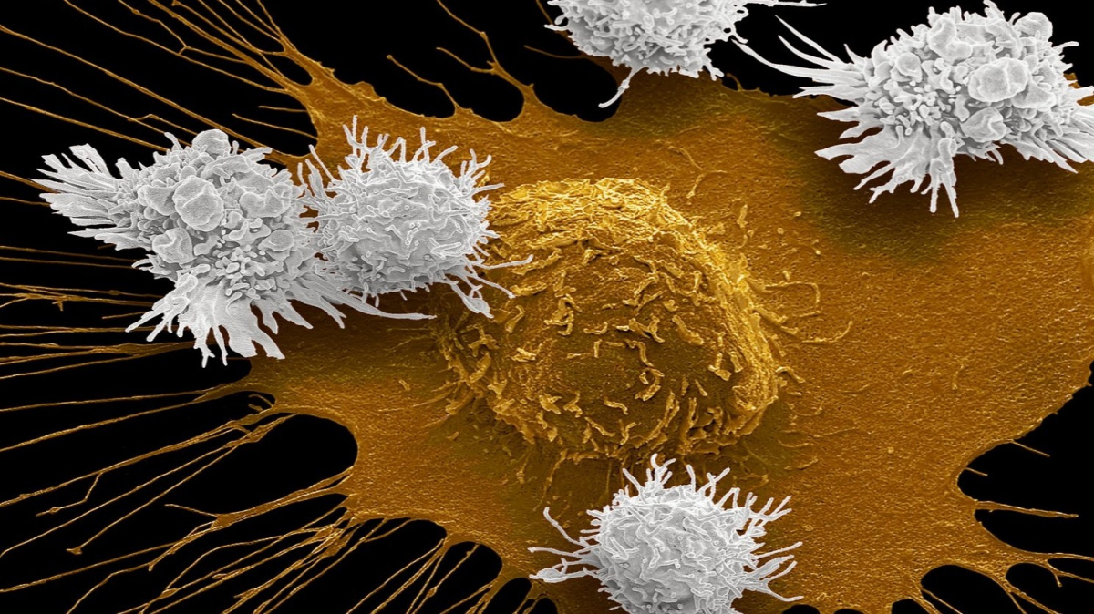 Nový lék slibuje průlom v léčbě rakoviny prsu