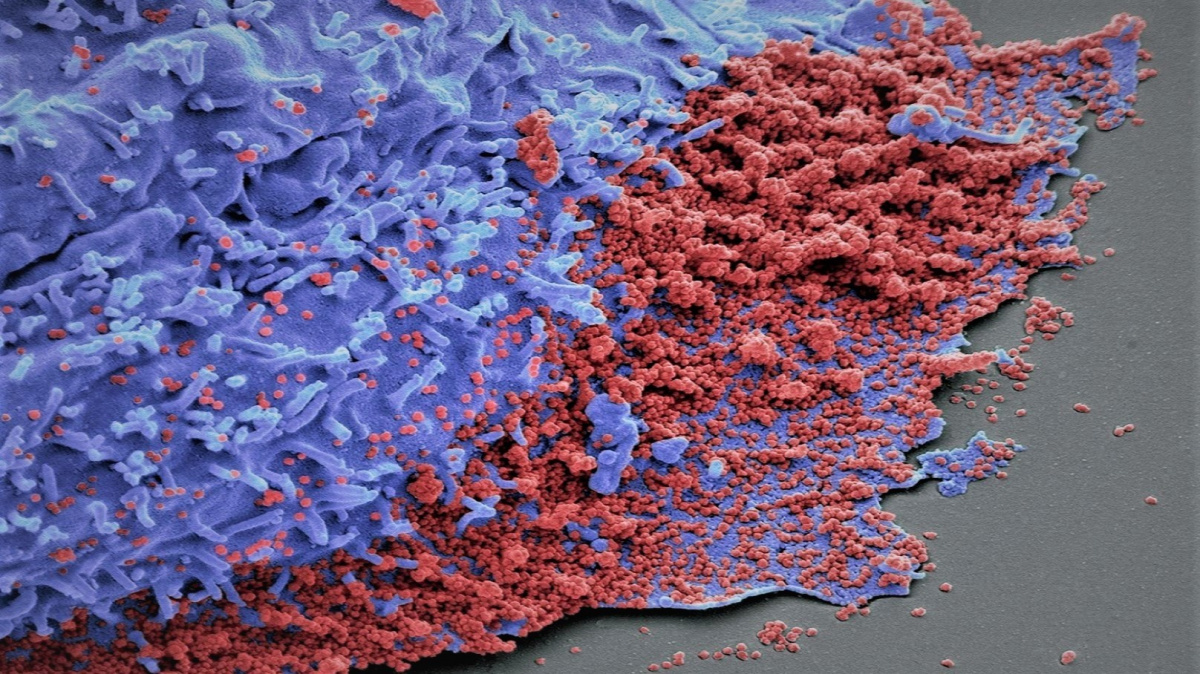 Proč je delta tak ďábelsky nakažlivá? Vědci odhalili její tajnou zbraň