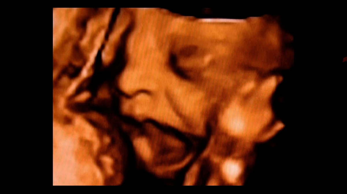 Pláčou děti už v děloze?