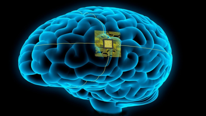 Myš, prase, opice... a teď člověk. Schyluje se k testům čipů v mozcích lidí