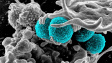 Odolné bakterie jsou třetím největším zabijákem lidí – větším než covid