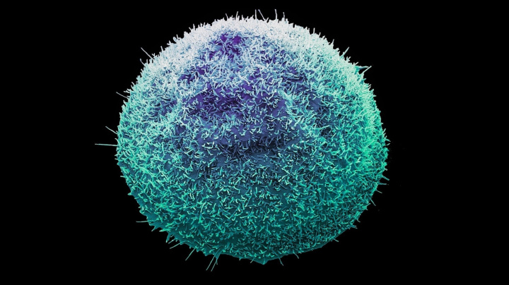 Experimentální přípravek vyléčil rakovinu u všech, kteří ho užívali