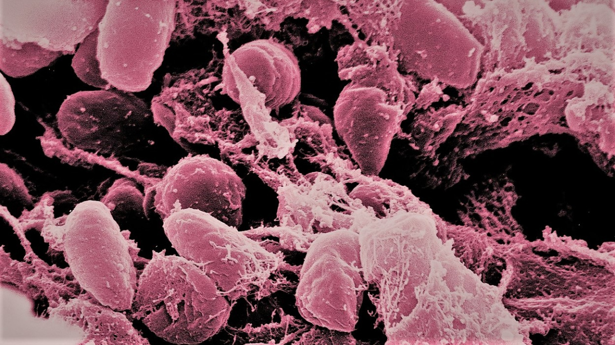 Vědci vyřešili záhadu starou 700 let. Zjistili, odkud se vzala černá smrt