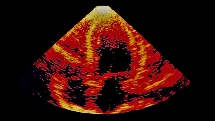 Revoluce v medicíně? Nalepíte si náplast, která ultrazvukem vyšetří vaše útroby