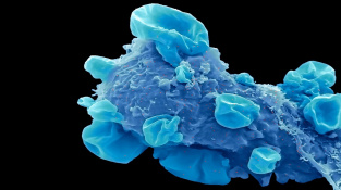 Omikronová varianta SARS-CoV-2 na kolorovaném snímku z elektronového mikroskopu. Je vidět jako tečky na buňce.