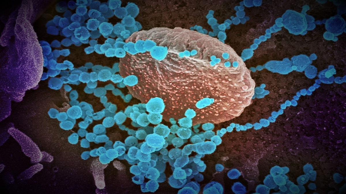 Začíná se šířit nový typ omikronu. Uniká starým vakcínám