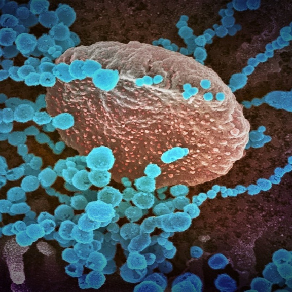 Začíná se šířit nový typ omikronu. Uniká starým vakcínám