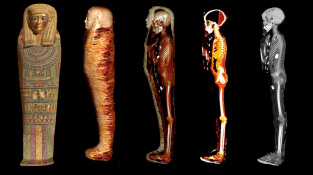 Badatelé digitálně rozbalili mumii ‚zlatého chlapce‘. Uvnitř spatřili zlatý poklad