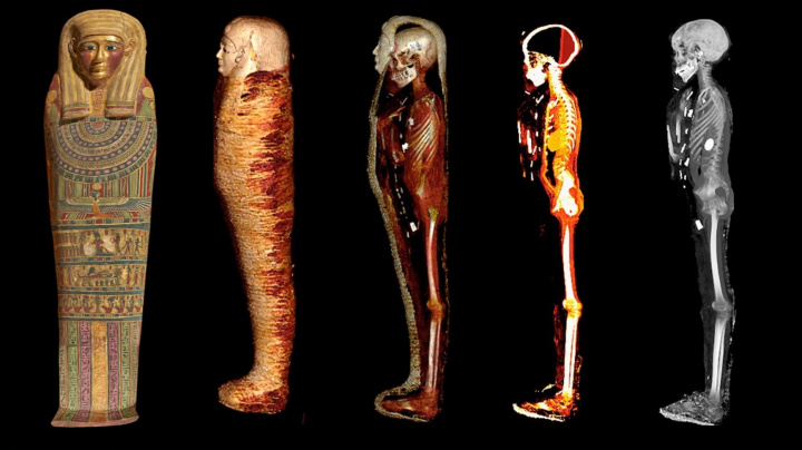 Badatelé digitálně rozbalili mumii ‚zlatého chlapce‘. Uvnitř spatřili zlatý poklad