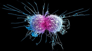 Dělení rakovinné buňky na kolorovaném snímku z elektronového mikroskopu.