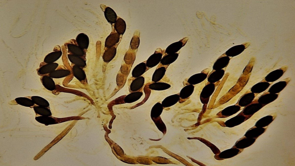 Houby naznačují, jak žít bez rakoviny