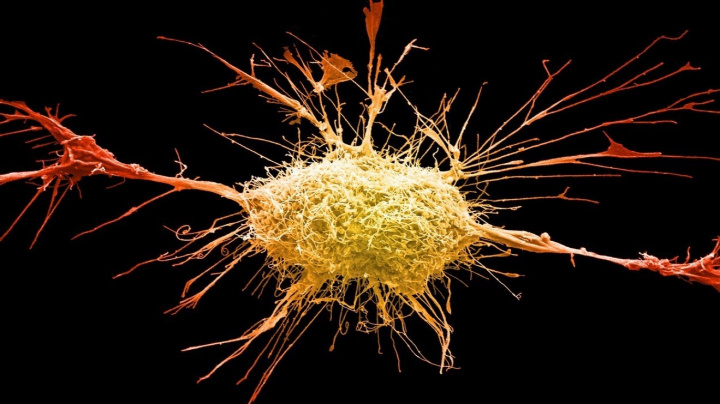 ‚Zázračná‘ molekula přiměla rakovinu spáchat sebevraždu