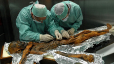 Ötzi