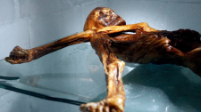 Ötzi