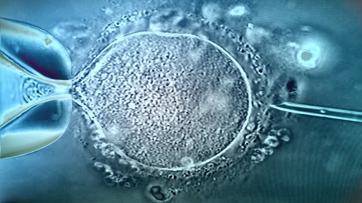 Hrozí příbuzenské křížení, dárcovství spermatu musíme regulovat, varuje vědec