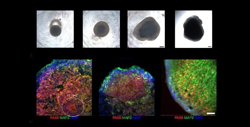 brain-organoids
