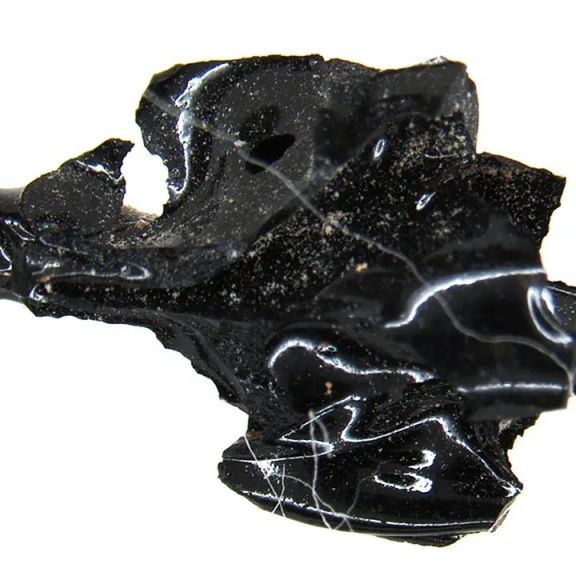 Vědci konečně objasnili tajemství muže se skleněným mozkem