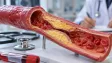 Cholesterol je nezbytný. Škodit ale může i tak
