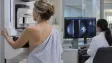 Co lidské oko nevidí: AI čte z běžného mamogramu budoucí riziko rakoviny prsu