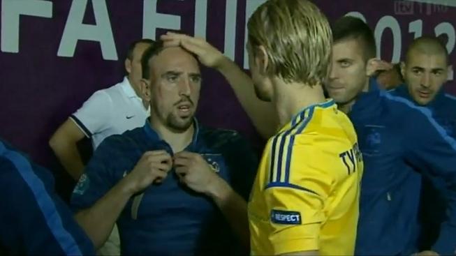 Ukrajinec Timoščuk Ribérymu před zápasem zničil účes!