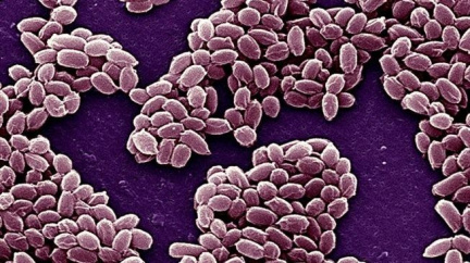 Ukrajina: Na pultech obchodů se objevilo maso s antraxem