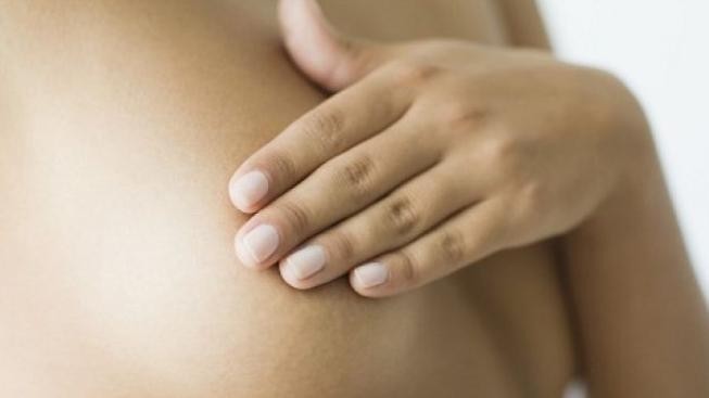 Nejsi na to sama: Jak zvládnout rakovinu prsu, radí lékaři i pacientky