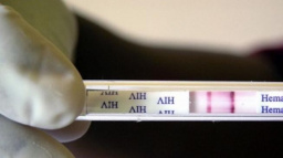 Suvenýry z dovolené: HIV a hepatitida. Experimentování nedoporučuji, varuje lékař