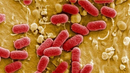 Střevní nákaza se poprvé přenesla z člověka na potraviny‎