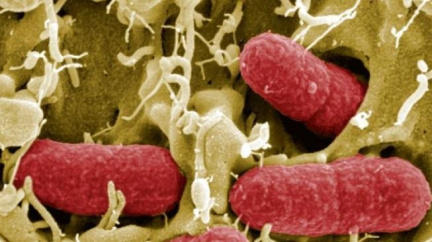 Současná smrtící bakterie je nejjedovatějším typem E.coli