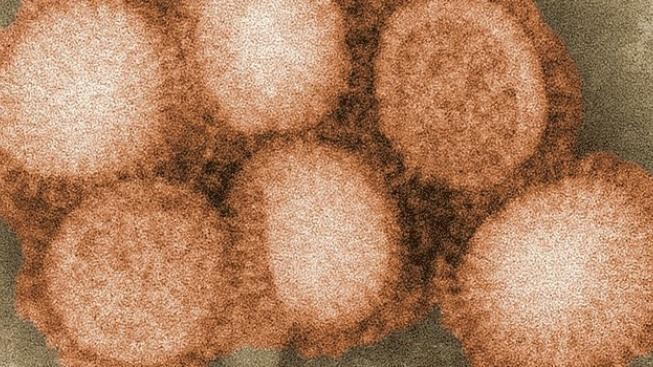 Chlapec, z jehož smrti viní rodiče lékaře, zemřel asi na chřipku