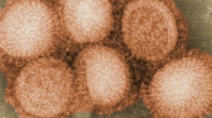 Chlapec, z jehož smrti viní rodiče lékaře, zemřel asi na chřipku