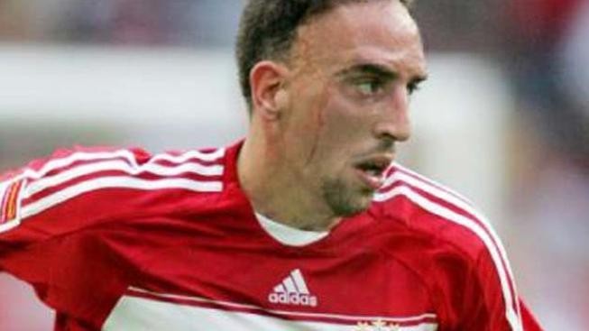Fotbalista Ribéry byl obviněn za styk s nezletilou prostitutkou