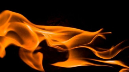 Na lehčí popáleniny pomáhá studená voda, na vážnější Hemagel