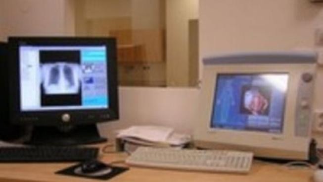 Jak předejít unaveným očím z počítače – 1. část