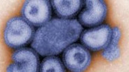 Podle WHO je pandemie H1N1 méně vážná než jiné vlny chřipky