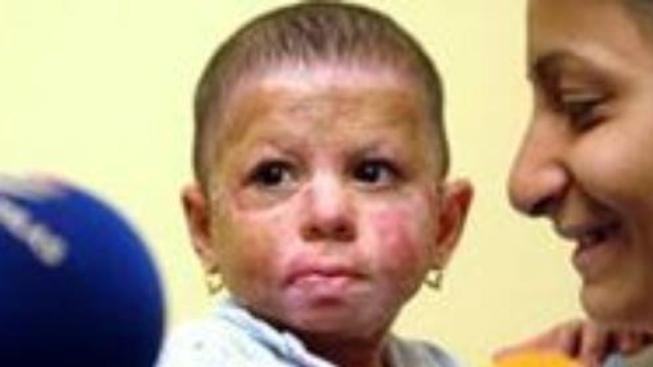 Státní zástupkyně podala obžalobu na žháře z Vítkova