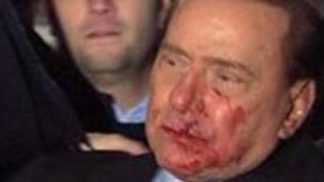 Berlusconi bude z nemocnice propuštěn ve středu