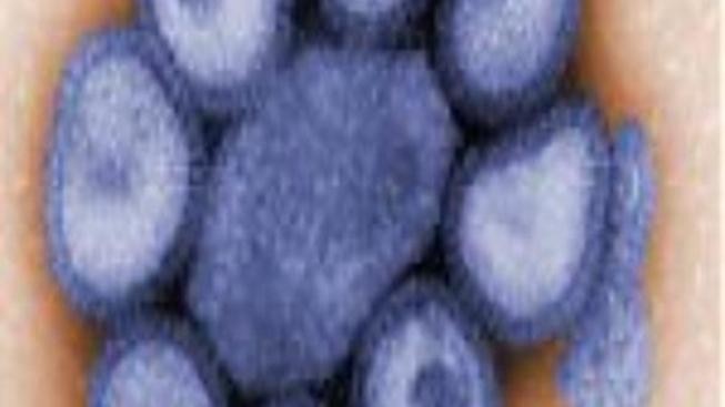 V Česku už zemřelo na prasečí chřipku sedm lidí