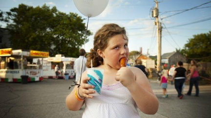 Studie: Obézní děti mají v dospělosti vyšší riziko infarktu a mozkové mrtvice