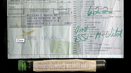 Na internetu se draží ampulka krve Ronalda Reagana