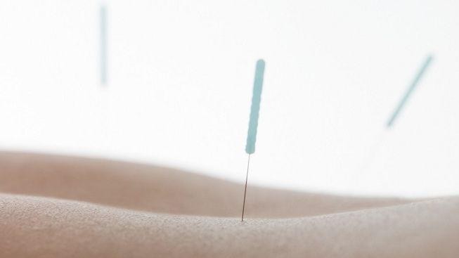 Zbavte se kouření. Pomůže vám akupunktura a hypnóza