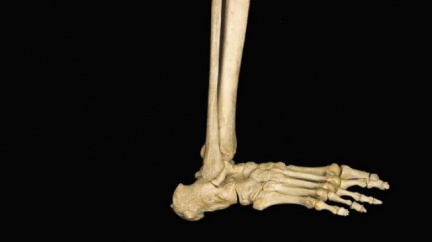 Nezaměstnaný muž si uřízl nohu. Chtěl neschopenku