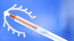 Zájem o nitroděložní tělísko proti otěhotnění roste