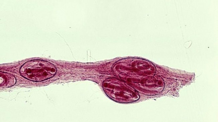 Šíření parazitů zvířat ze souše do moře