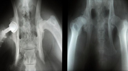 Artrózu mají v ČR dva miliony lidí, hlavní prevencí je pohyb 