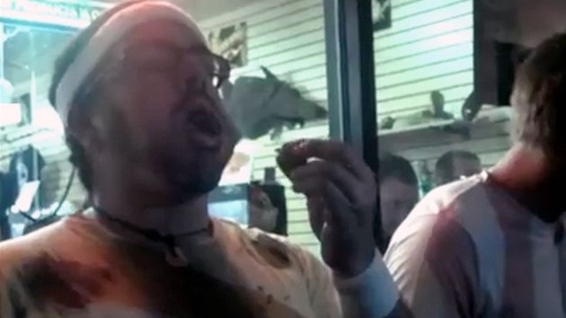 Soutěž v pojídání švábů skončila smrtí vítěze