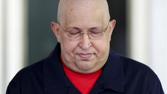 Chávez v kritickém stavu bojuje o život