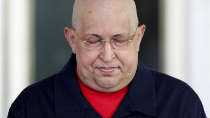 Chávez trpí novými pooperačními komplikacemi. Má zánět dýchacích cest